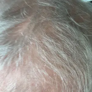 G***A